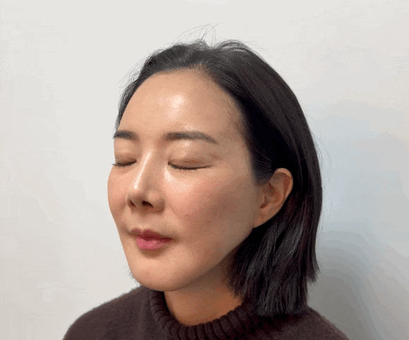 눈꼬리 리프팅, 고양이상이 되고 싶으면 이 글을 보세요! 관련 이미지 12