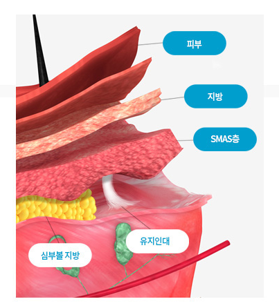 저스트 성형외과만의 특별한 안면거상술! 관련 이미지 3