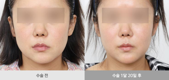 Silhouette Soft: If You Haven’t Tried It Yet, You Can Skip This Post. image 9