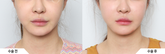 💡 My Facial Features Are Fine, So Why Don’t I Look Pretty? image 2