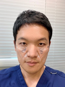 I Personally Received Rituo Plus Peach Lifting from Dr. Pyo Seung-beom! image 2