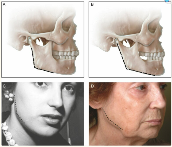 Do Signs of Aging in Appearance Accelerate Sharply in Your 40s and 50s? — JUST’s Solution image 1