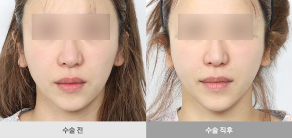 Silhouette Soft: If You Haven’t Tried It Yet, You Can Skip This Post. image 7