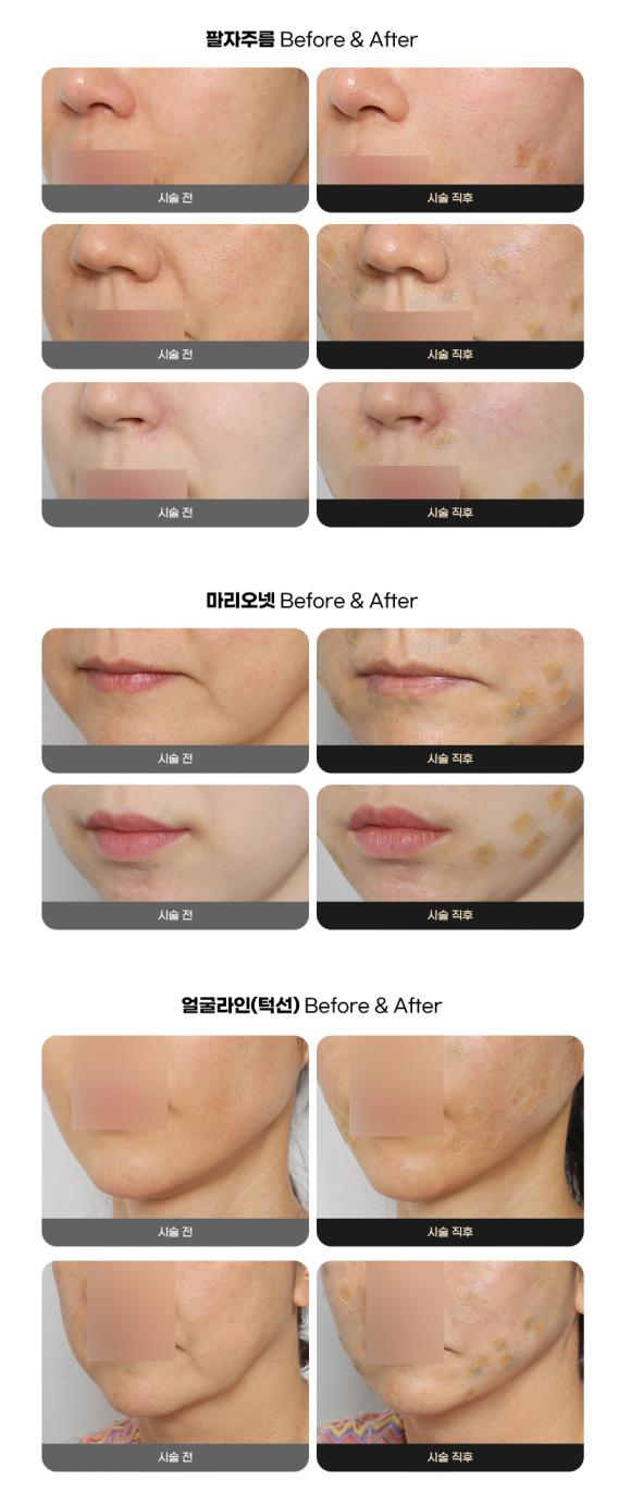 트리플 에그가 특별한 이유 ✨ 관련 이미지 2