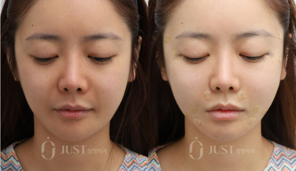 Silhouette Soft: If You Haven’t Tried It Yet, You Can Skip This Post. image 12