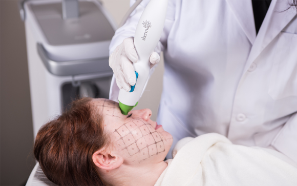 Thermage Is Good for Fine Wrinkles — Why Thermage FLX Is So Popular at Just Plastic Surgery! image 6