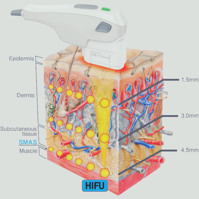 홍대 포텐자, 차이점과 주의사항 총정리 관련 이미지 7