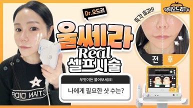 홍대세소 Sudden Attack 🧡리프팅편🧡 관련 이미지 2