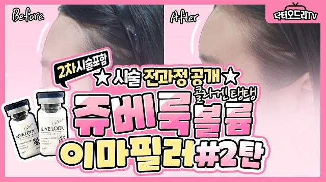 세가지소원의원홍대 🥰 2월이벤트🥰 관련 이미지 13