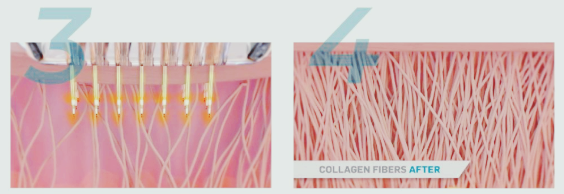 홍대 포텐자, 차이점과 주의사항 총정리 관련 이미지 9