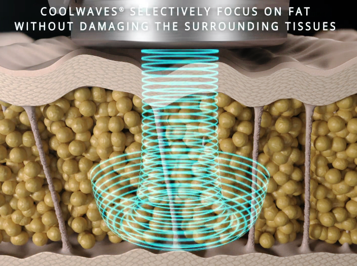홍대 온다리프팅, 언제 그리고 왜 필요할까? 관련 이미지 5