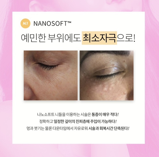 홍대피부과 여드름 모공축소 피부매끈매끈 발광테라피 트로필 티파니주사는 여기 관련 이미지 16