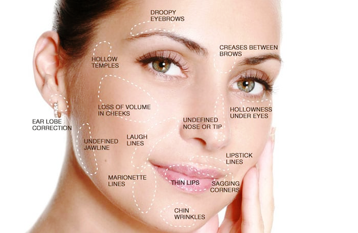 홍대 필러 피부과, 관련 이미지 6