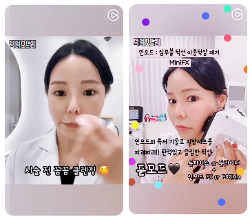 홍대 피부과 추천? 후기만 믿으면 후회하는 이유 관련 이미지 5