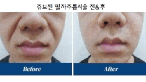 세가지소원의원 홍대피부과 8월이벤트 관련 이미지 5