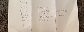 오원장의 육아일기 : 준수 다시 39도 고열증상 🥵🤒 파라인플루엔자 재감염?? >>아데노바이러스 감염?!😱😭😭 고열, 콧물, 인후통, 설사 동반 (기침x) 관련 이미지 21
