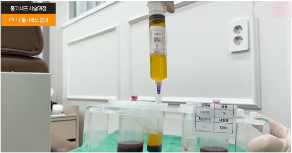 홍대 줄기세포? 핵심만 정리했습니다. 관련 이미지 8