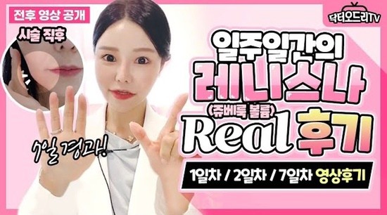 2022 홍대세소 💕코레지 에그🥚리프팅 런칭이벤트 관련 이미지 6