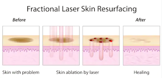 연남동 피부과, 여드름이 고민이시라면 필독 관련 이미지 4