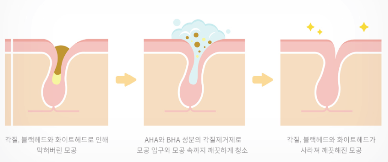 홍대 아쿠아필, 대표원장이 직접 알려드릴게요! 관련 이미지 4