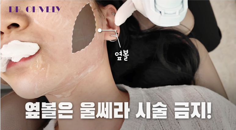 서울 울쎄라, 자주 묻는 질문 BEST 3는? 관련 이미지 10