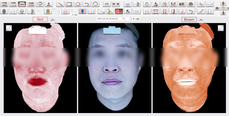 합정피부과, 같은 시술 왜 결과는 다를까? 관련 이미지 9