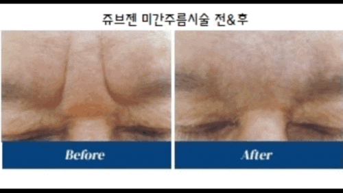 세가지소원의원 홍대피부과 8월이벤트 관련 이미지 6