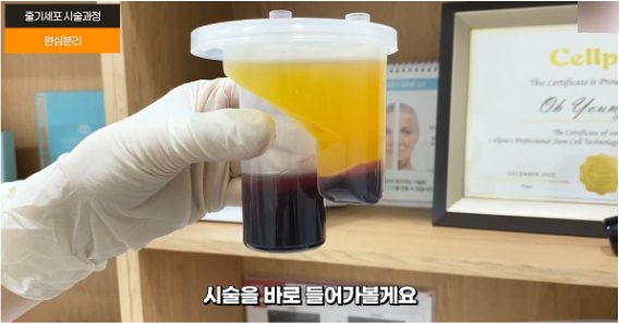 홍대 줄기세포? 핵심만 정리했습니다. 관련 이미지 5