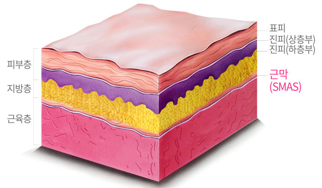 홍대 울쎄라 vs 슈링크, 어떤 리프팅이 나에게 맞을까? 관련 이미지 5