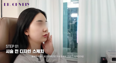 서울 울쎄라, 자주 묻는 질문 BEST 3는? 관련 이미지 12