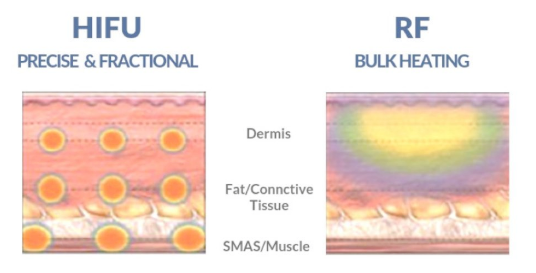 홍대 올리지오, 이것만은 꼭 알고 선택하세요 관련 이미지 4
