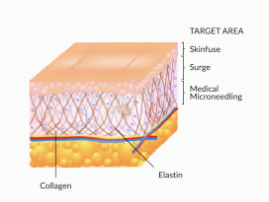 홍대 리쥬란, 정말 피부가 재생되나요? 관련 이미지 9