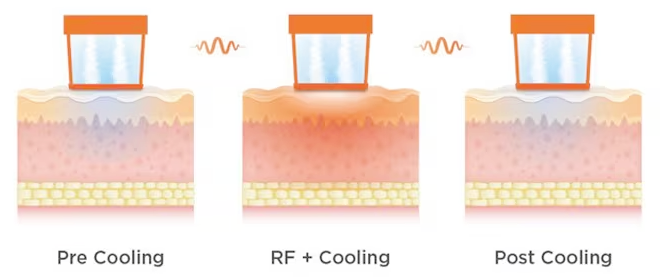 홍대 올리지오, 이것만은 꼭 알고 선택하세요 관련 이미지 6