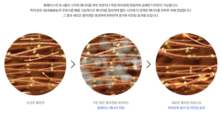 홍대 튠페이스, 효과적인 경우 vs 그렇지 않은 경우? 관련 이미지 5