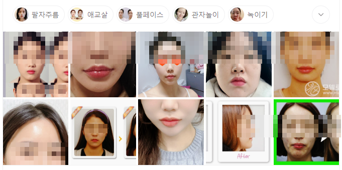 홍대 필러 피부과, 관련 이미지 2