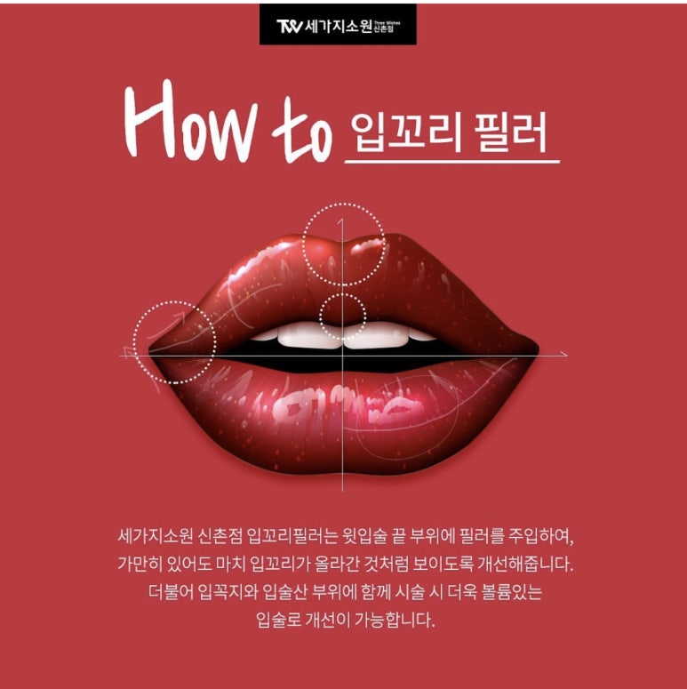 세가지소원 신촌점 (구 신촌미클리닉) ★2월 이벤트★ 관련 이미지 9