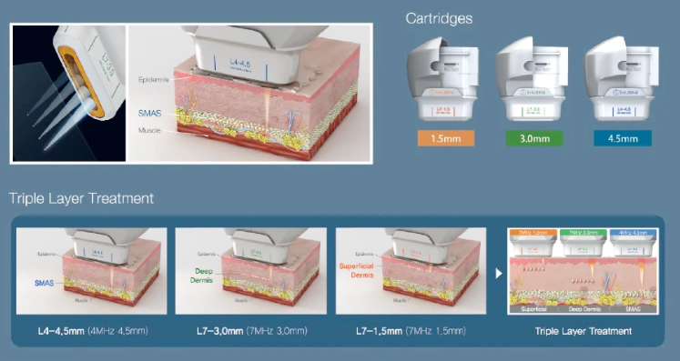 홍대 슈링크, 현직 의사가 알려드립니다. 관련 이미지 3