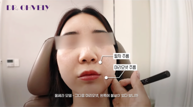 서울 울쎄라, 자주 묻는 질문 BEST 3는? 관련 이미지 13