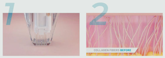 홍대 포텐자, 차이점과 주의사항 총정리 관련 이미지 8