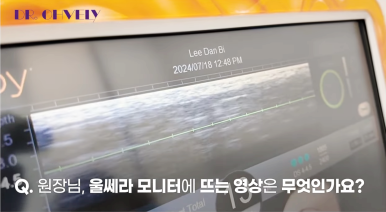 서울 울쎄라, 자주 묻는 질문 BEST 3는? 관련 이미지 8