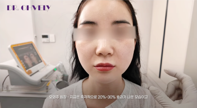 서울 울쎄라, 자주 묻는 질문 BEST 3는? 관련 이미지 4