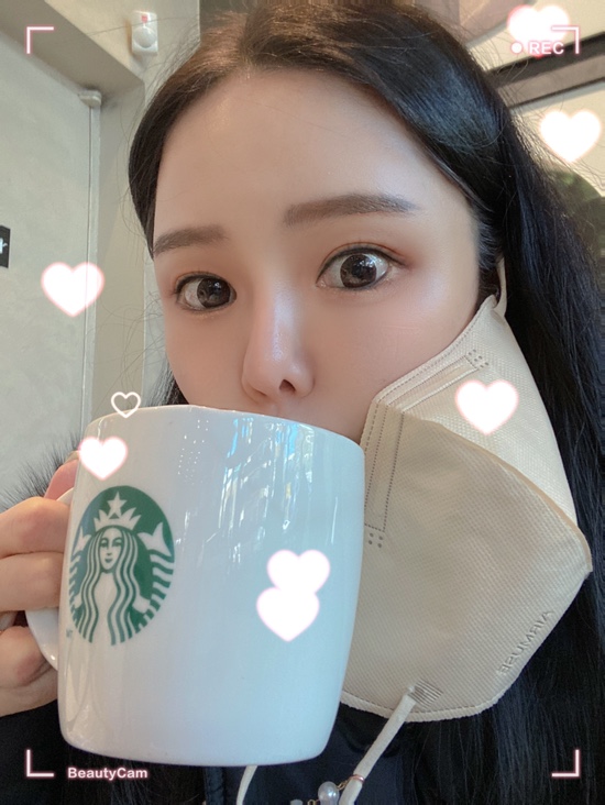 오원장의 육아일기 : 준수 다시 39도 고열증상 🥵🤒 파라인플루엔자 재감염?? >>아데노바이러스 감염?!😱😭😭 고열, 콧물, 인후통, 설사 동반 (기침x) 관련 이미지 50