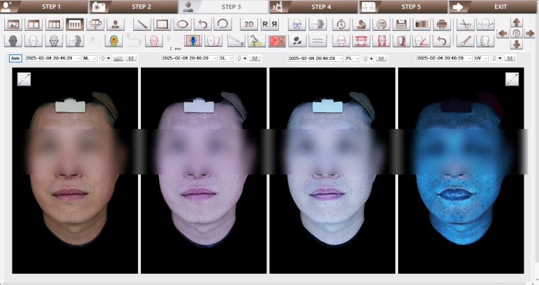 합정피부과, 같은 시술 왜 결과는 다를까? 관련 이미지 10