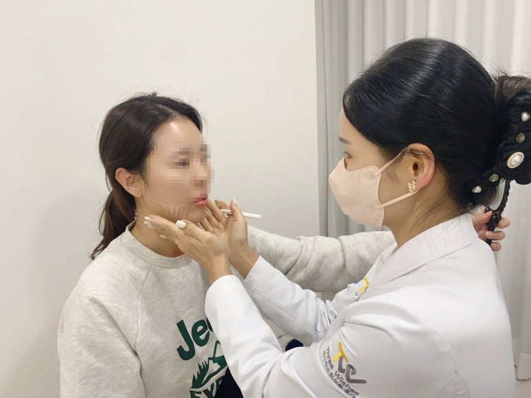 팔자주름 보톡스, 진짜 효과가 있을까? 관련 이미지 9