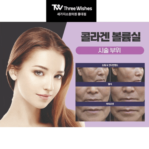 홍대세가지소원피부과 봄맞이 일타시술이벤트 관련 이미지 5