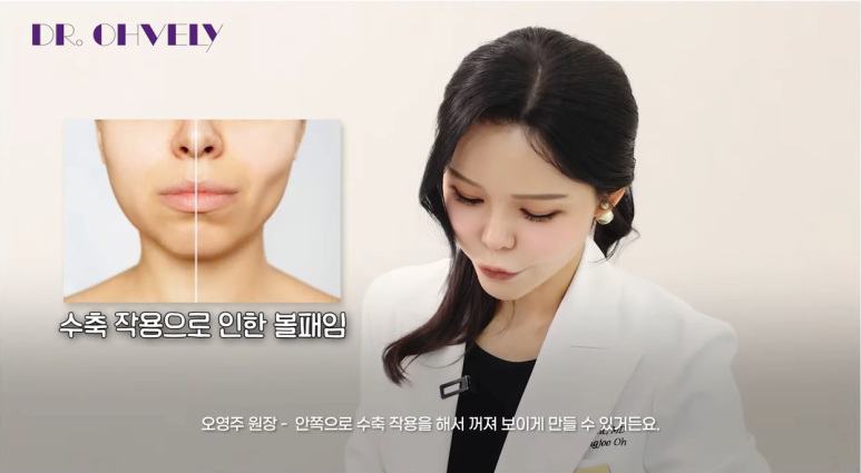 서울 울쎄라, 자주 묻는 질문 BEST 3는? 관련 이미지 11