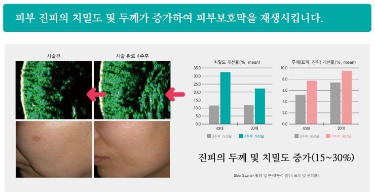[잠실 연세힐피부과]건강한 아름다움을 원하다면 관련 이미지 2