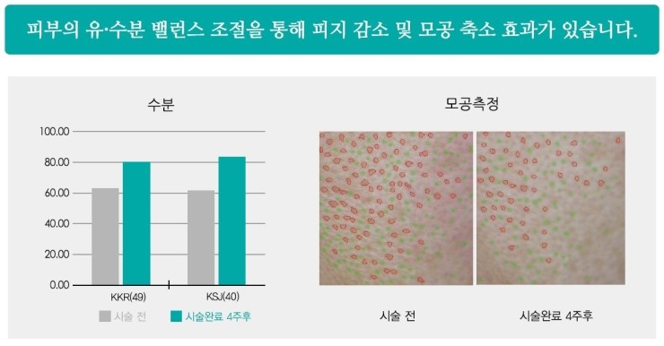 [잠실 연세힐피부과]건강한 아름다움을 원하다면 관련 이미지 6