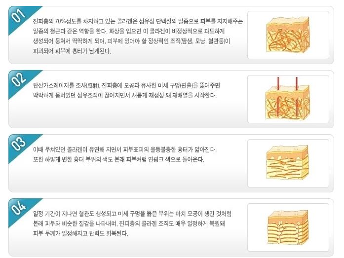[잠실 연세힐피부과]"핀홀법"을 이용한 화상흉터의 치료 관련 이미지 1