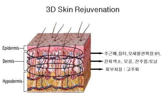 3차원 피부 재생술(3D Skin Rejuvenation) - 건강하고 깨끗한 피부를 위한 토탈 솔루션 관련 이미지 1